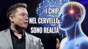 CHIP NEL CERVELLO NEURALINK